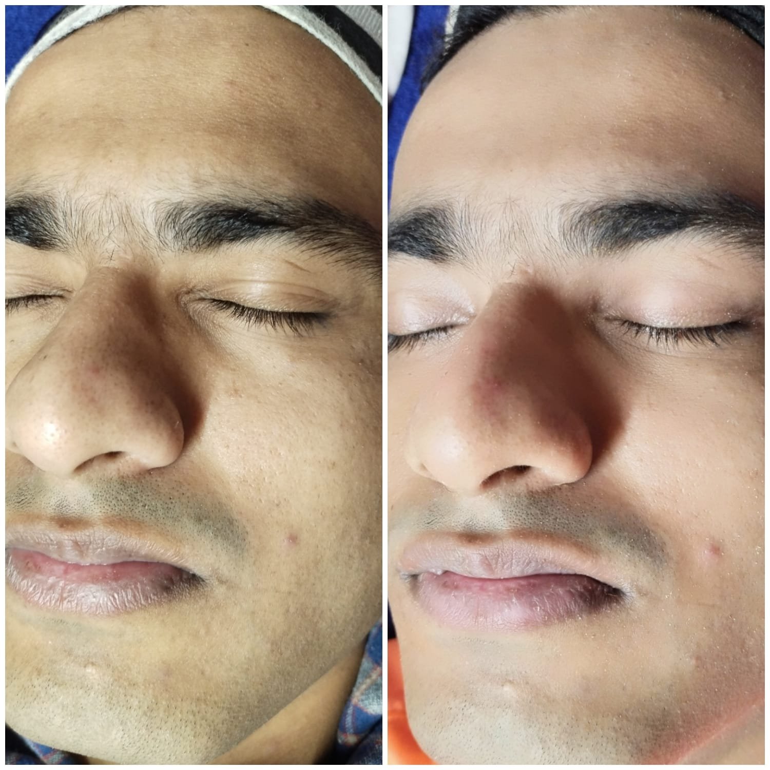 best skin treatment clinic in greater noida