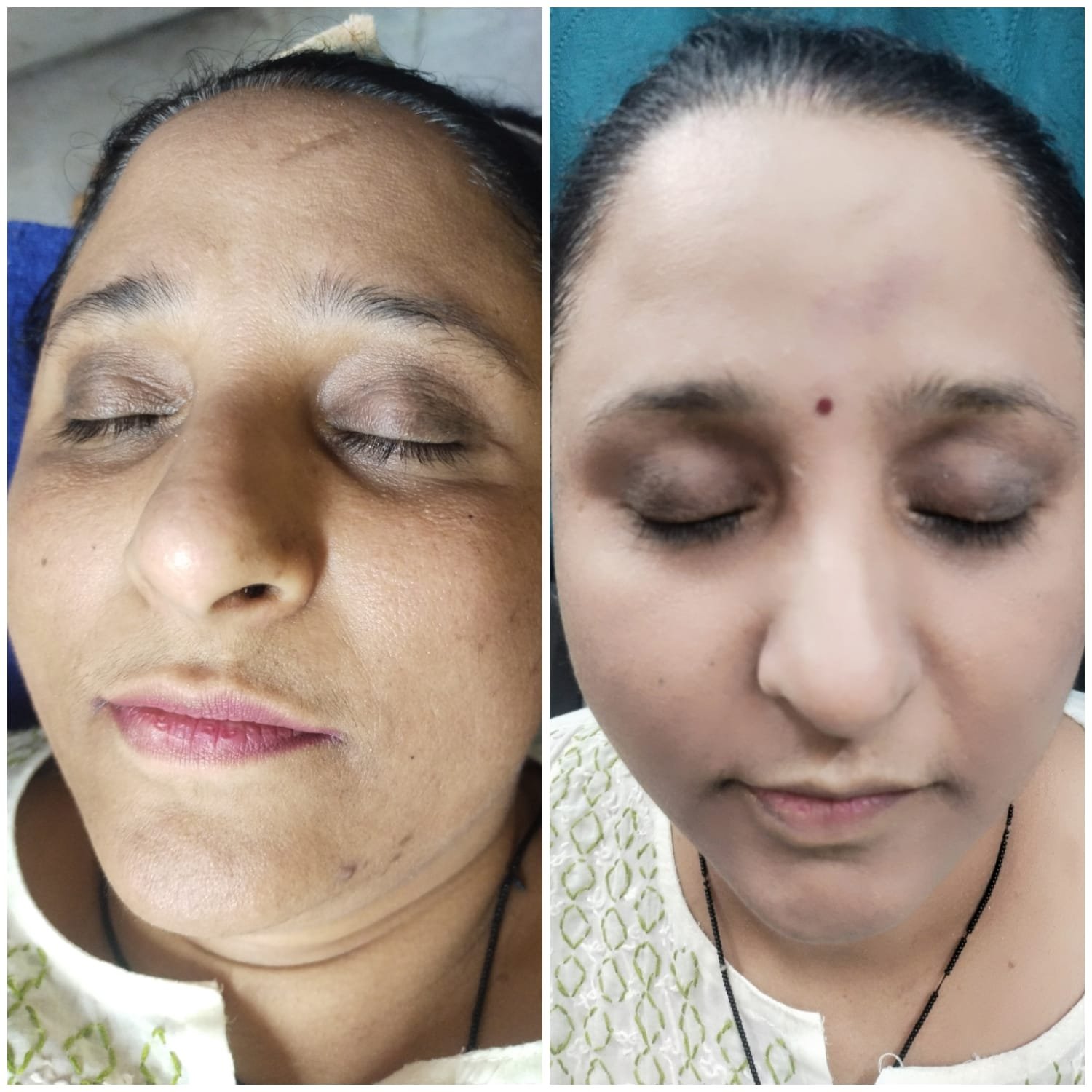 best skin treatment clinic