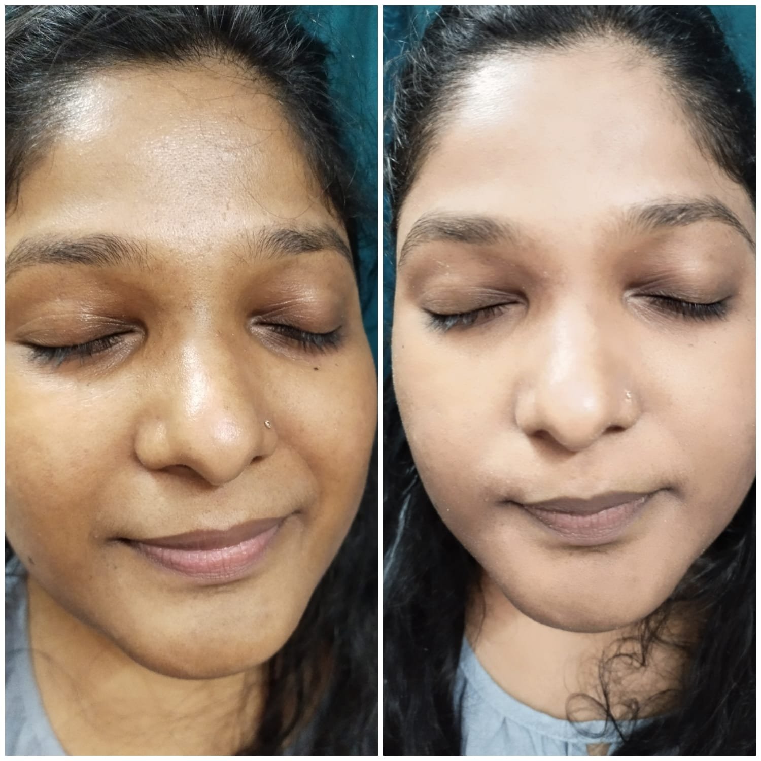 best skin treatment in greater noida west