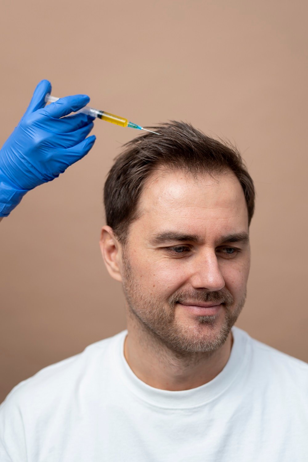 hair transplant in greater noida
